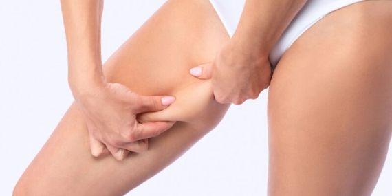 Uyluk Germe Ameliyatı ile Sıkı ve Estetik Bacaklar: Op. Dr. Gökhan Semerci’den Uzman Yaklaşım