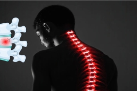 Osteoporoz ve Omurga Kırıklarında Kifoplasti Yönteminin Önemi