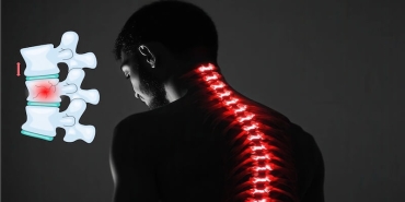 Osteoporoz ve Omurga Kırıklarında Kifoplasti Yönteminin Önemi