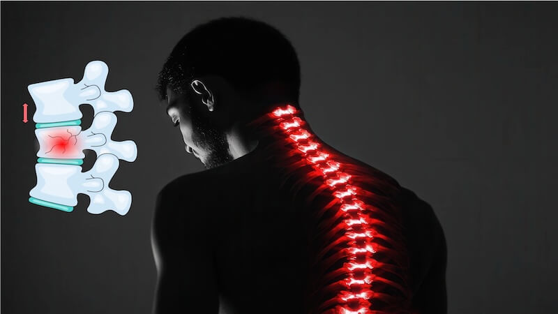 Osteoporoz ve Omurga Kırıklarında Kifoplasti Yönteminin Önemi